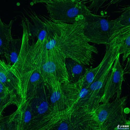 ϸ���Ǽ�Ⱦɫ